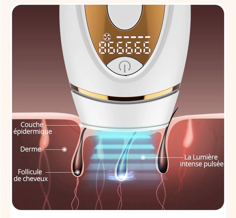 Épilation définitive à la lumière pulsée - Best Dépil™
