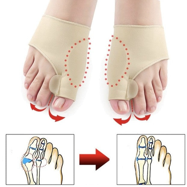Hallux Valgus toe separator bunion corrector, toe straightener, foot pain relief, orthopedic pedicure tools 1 pair - FootComfort™