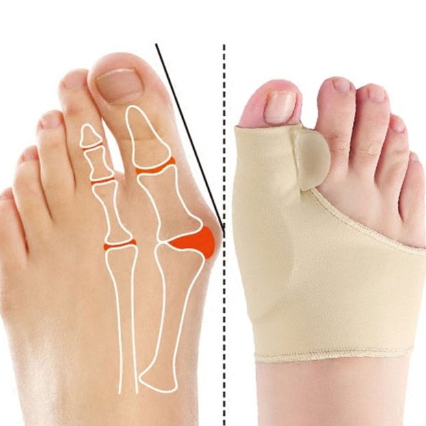 Hallux Valgus toe separator bunion corrector, toe straightener, foot pain relief, orthopedic pedicure tools 1 pair - FootComfort™